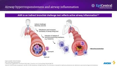 Airway hyperresponsiveness and remodelling in asthma phenotypes