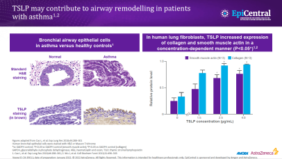 Epithelial cytokines and the clinical features of asthma - slide content