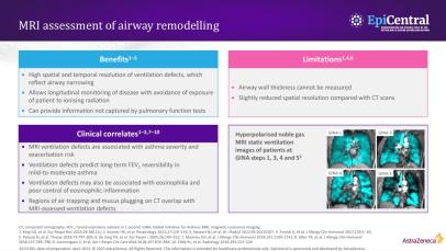 Imaging of airway remodelling