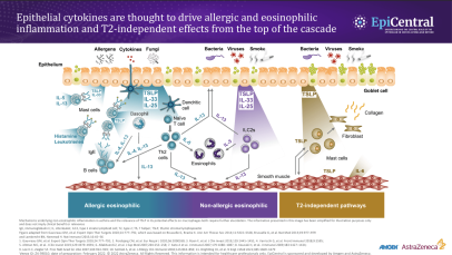 The inflammatory cascade - schematic