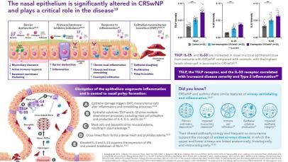 Nasal Polyp infographic