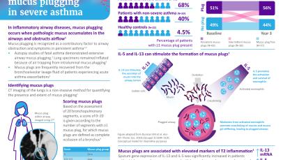 Mucus Plugging Infographic thumbnail