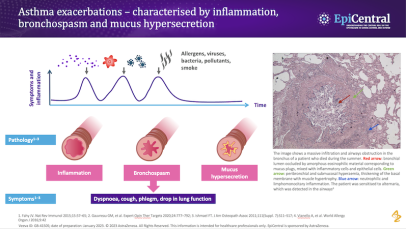 Impact of environmental triggers and seasonality on the epithelium - teaser thumbnail