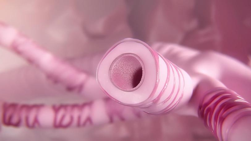 Remission thumbnail