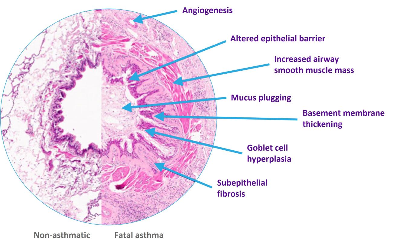 EpiCentral Global Remodelling image